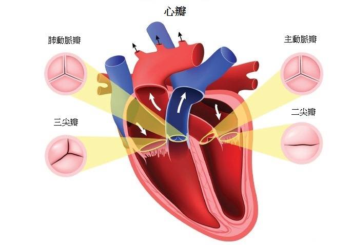 心脏瓣膜病